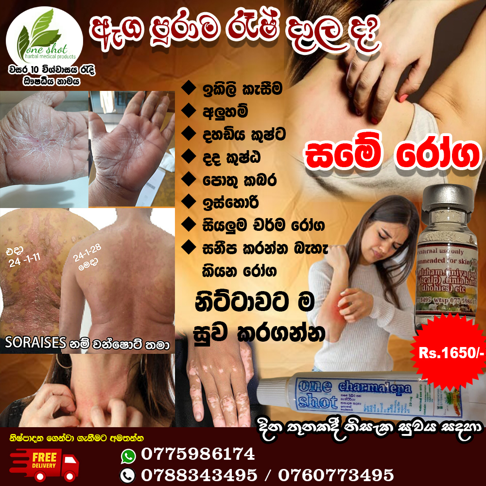 lanka top ads